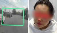 Wanita Paruh Baya di Pangkalpinang Dijambret, Jatuh dari Motor hingga Tulang Lengan Kiri Patah